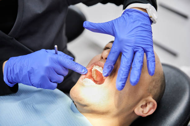 Best Emergency Gum Treatment in Southgate, FL